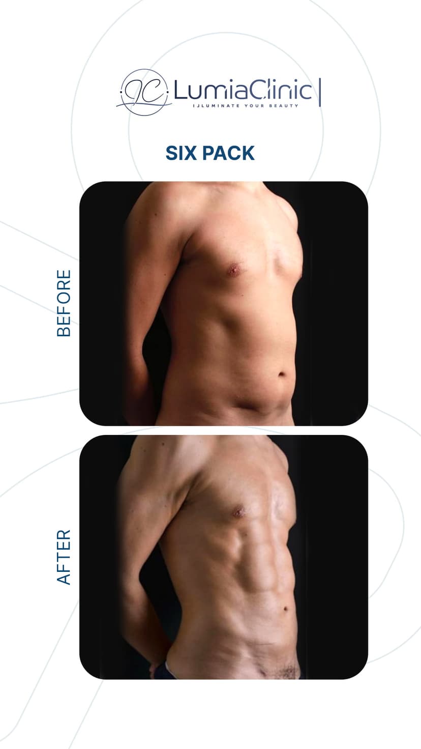 Six Packs before and after 2