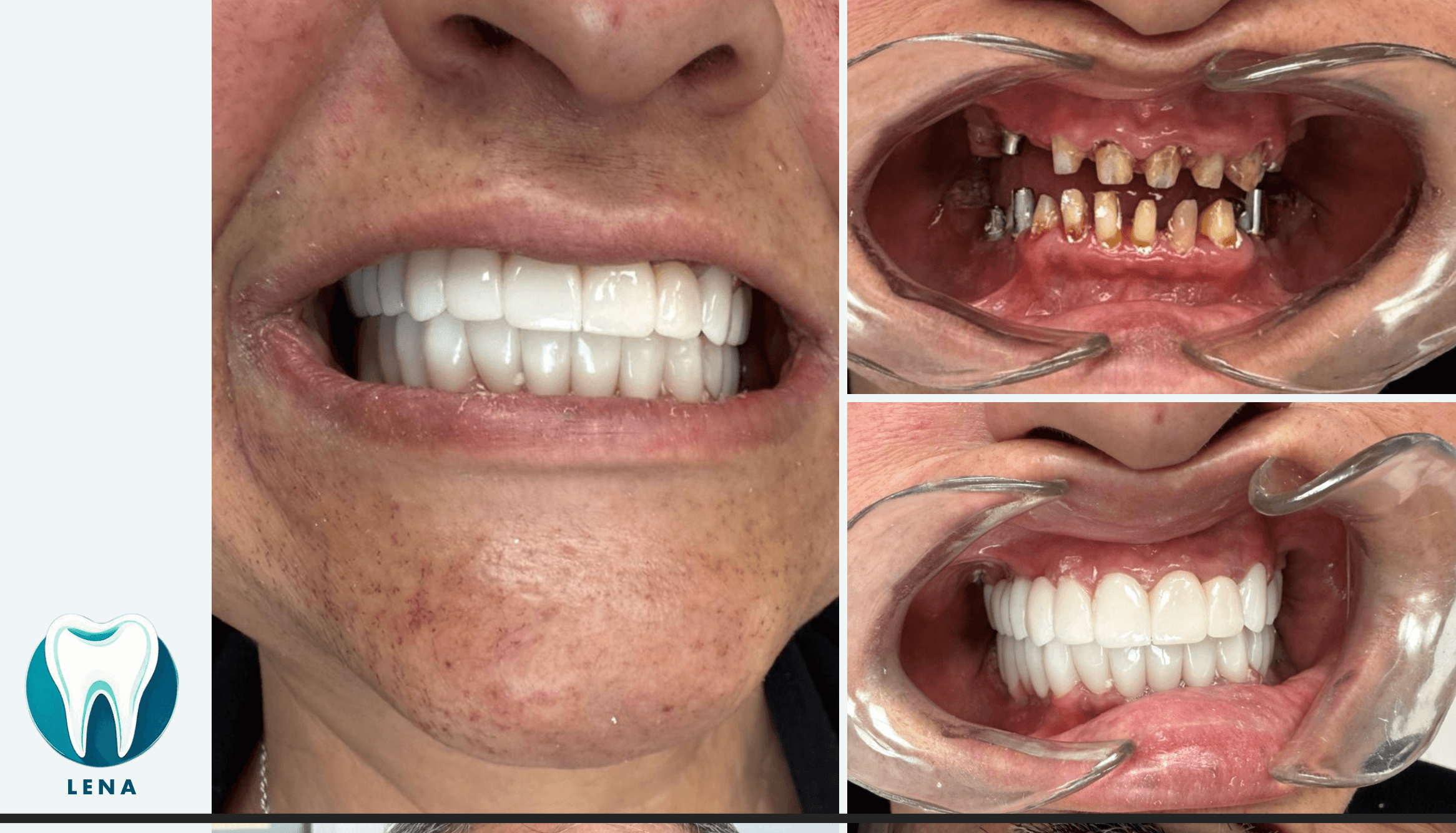 Dental before and after 1