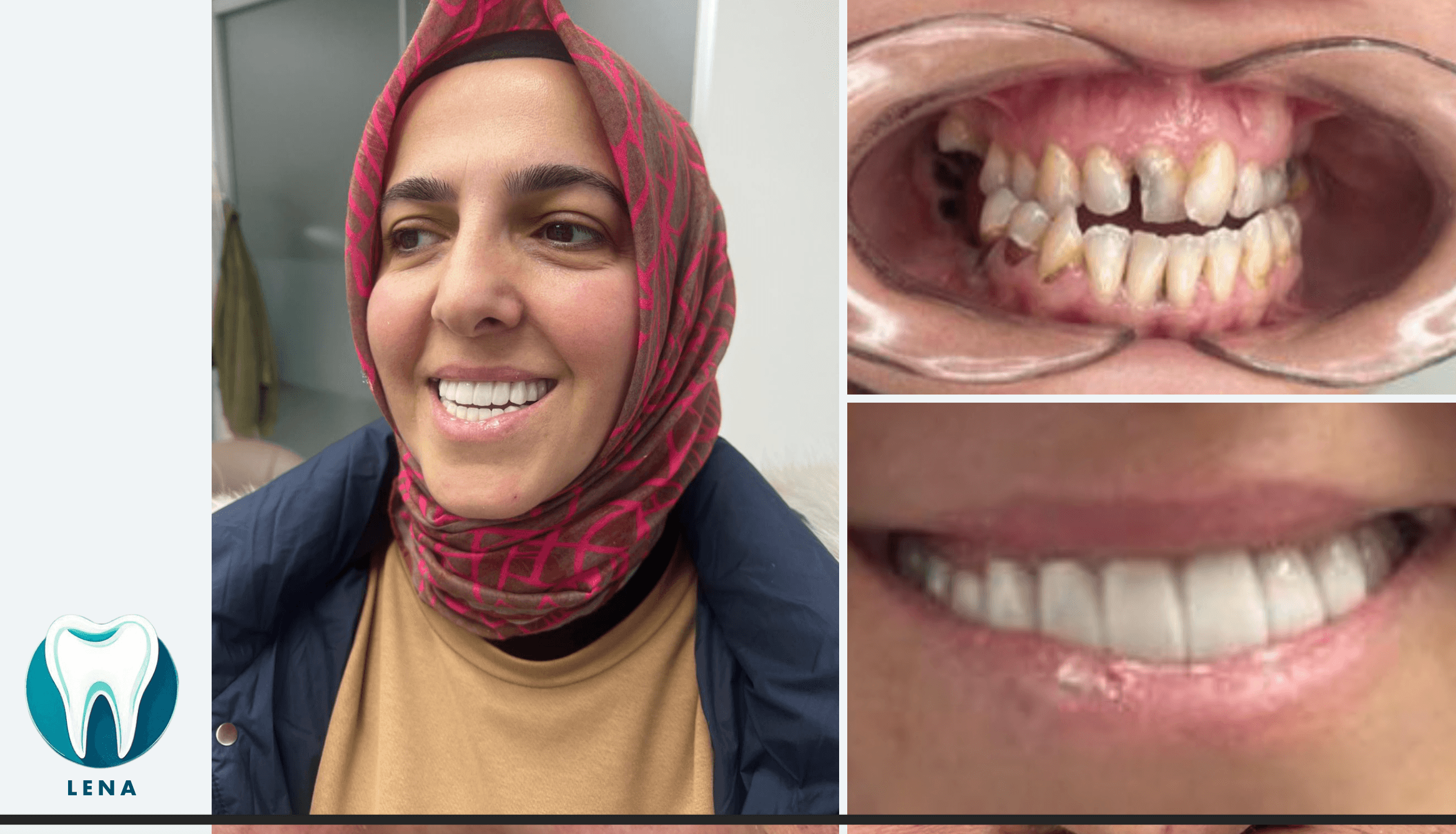 Dental before and after 3
