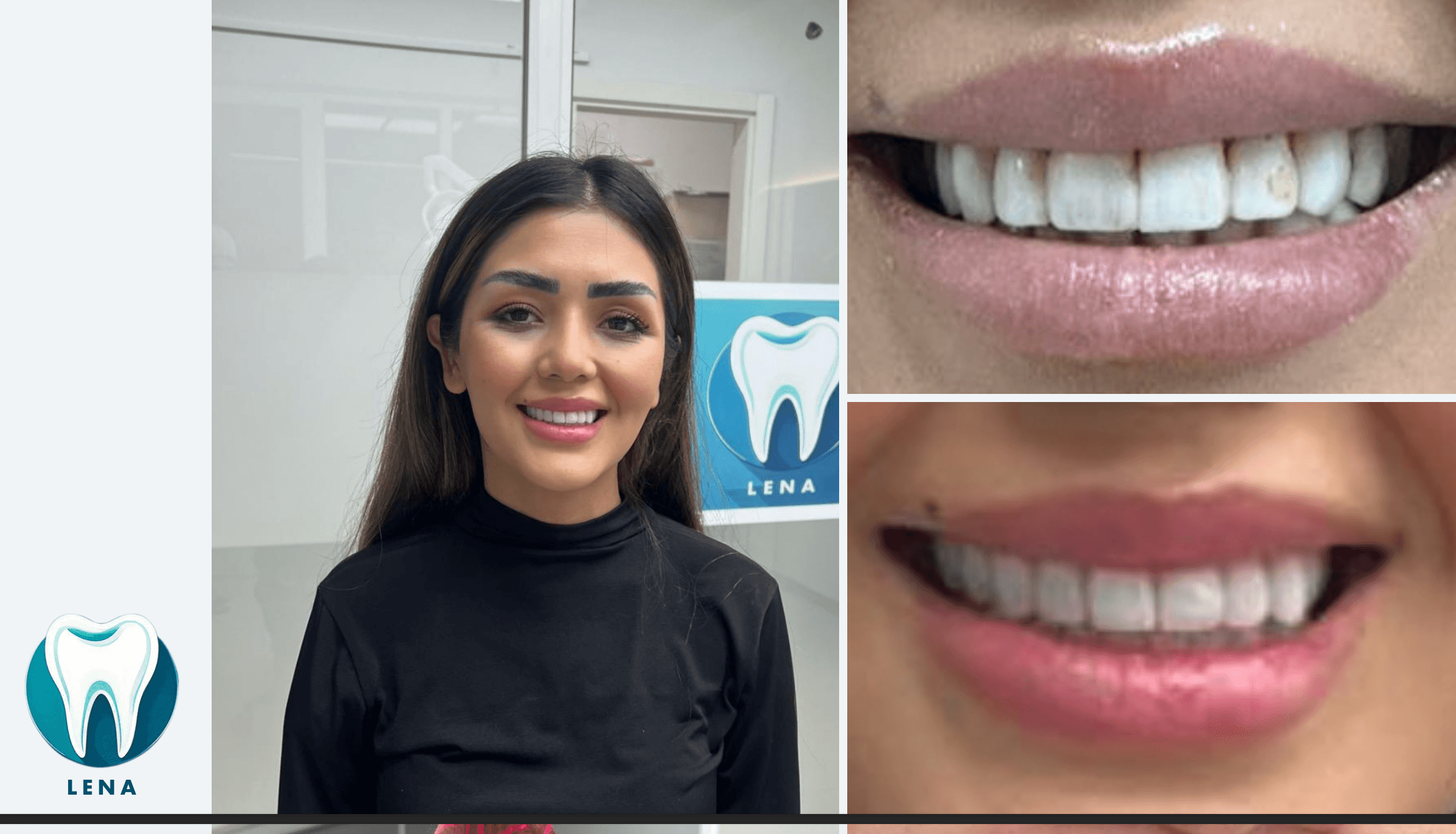 Dental before and after 4