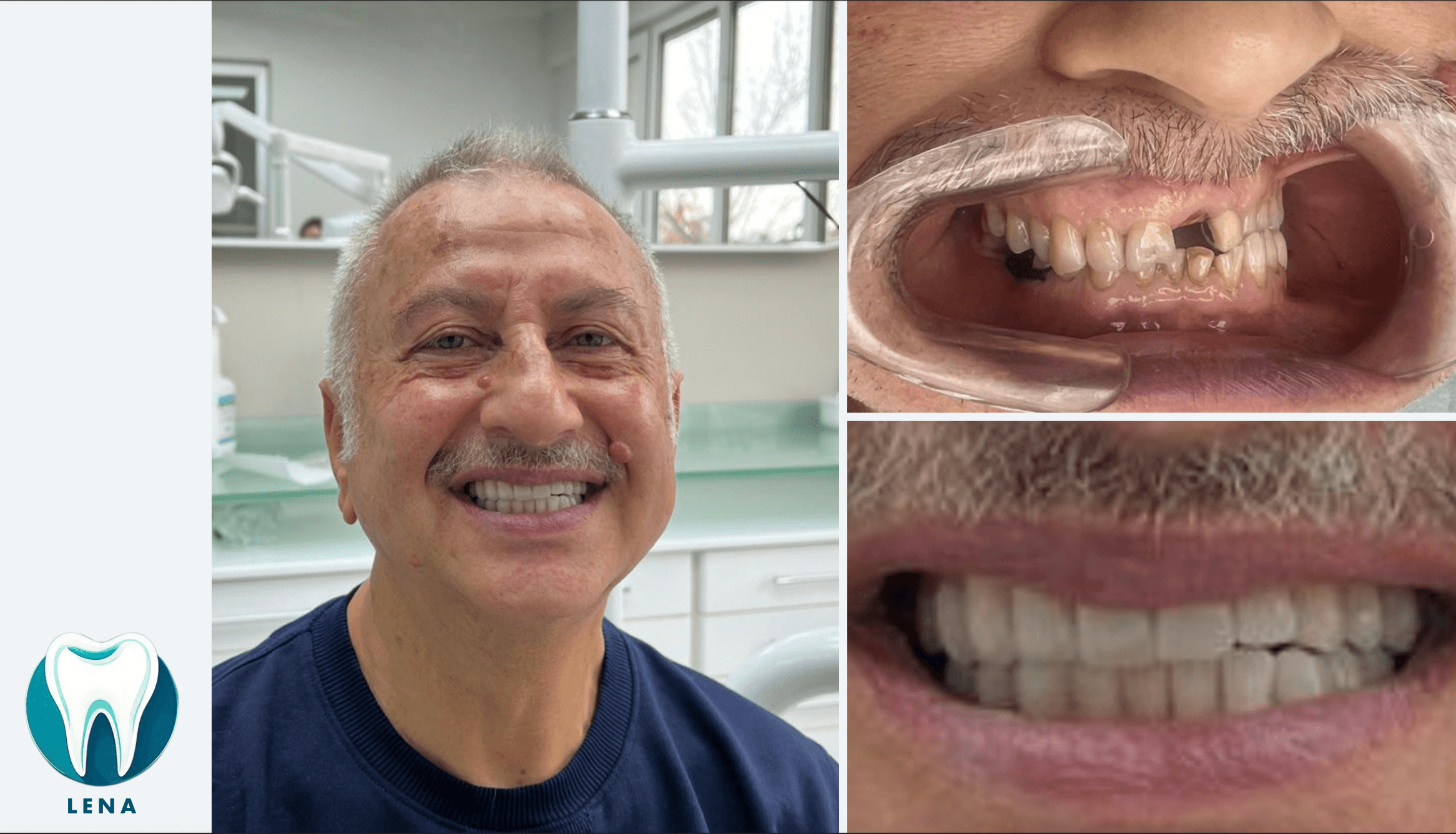 Dental before and after 5