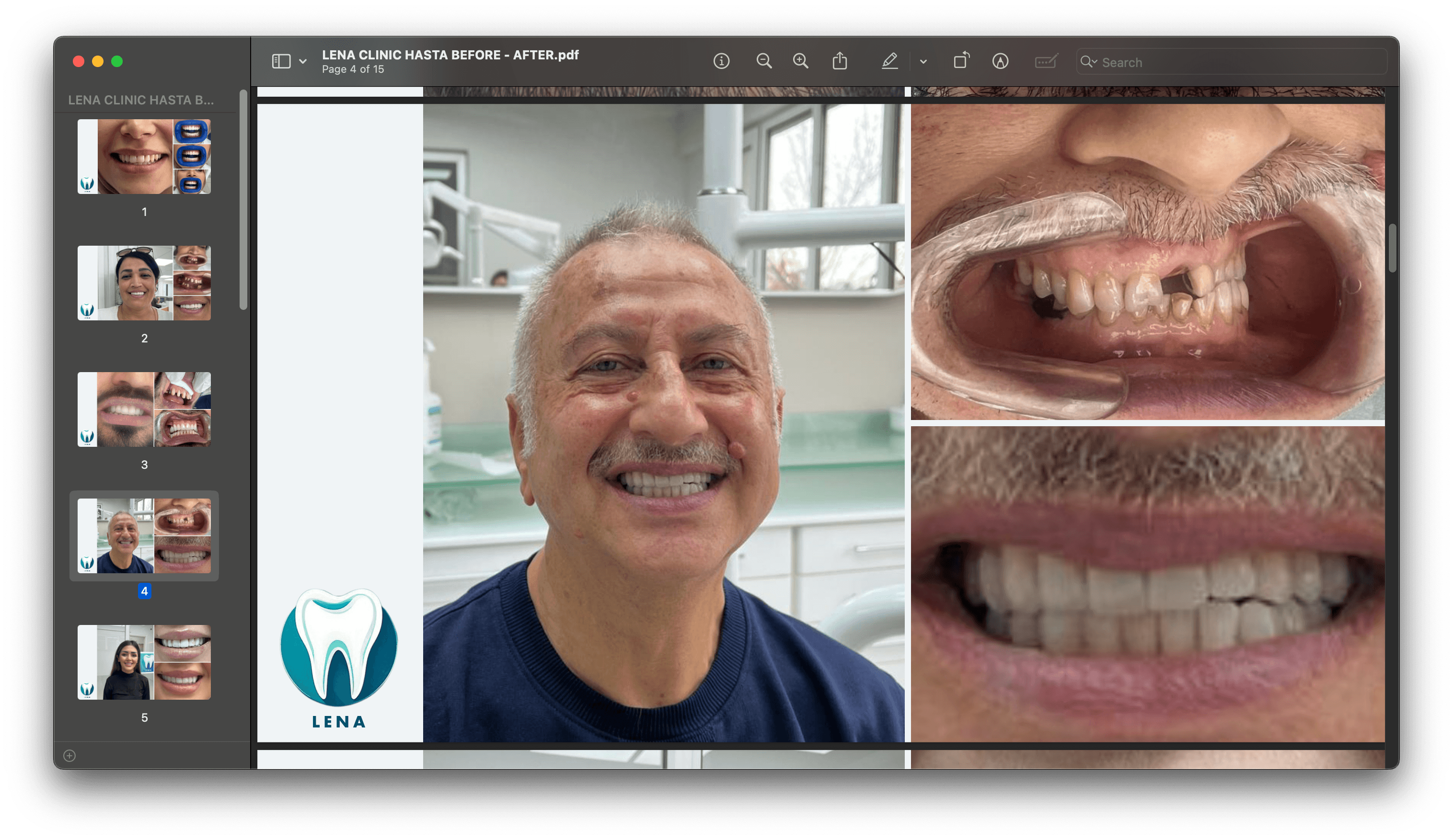 Dental before and after 6