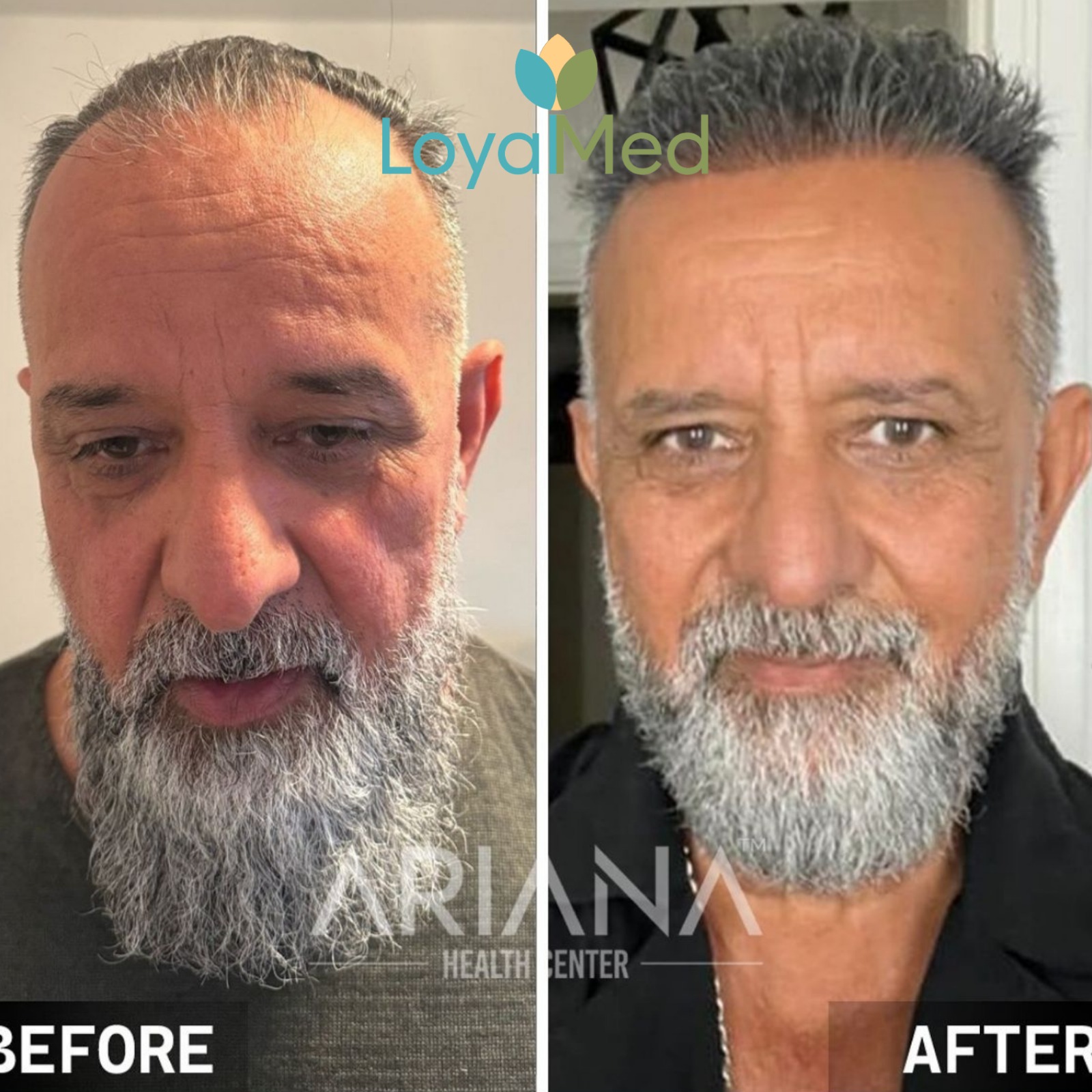 Before and After 8